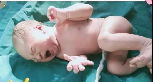 同样是“足月”，胎儿37周和40周出生有什么区别？